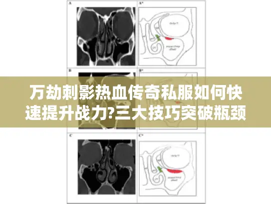 万劫刺影热血传奇私服如何快速提升战力?三大技巧突破瓶颈 万劫刺影热血传奇私服如何快速提升战力?三大技巧突破瓶颈